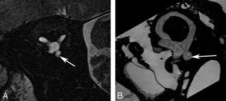 Fig 6.