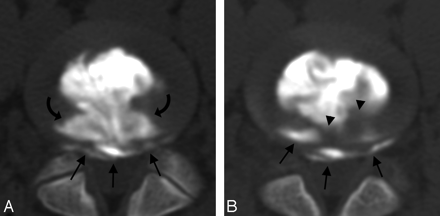Fig 3.