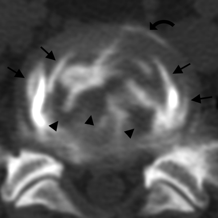 Fig 4.