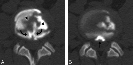 Fig 5.
