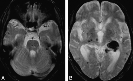 Fig 1.