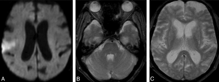 Fig 2.