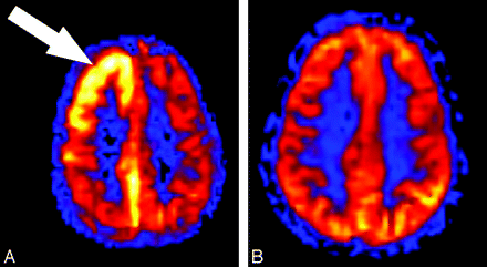 Fig 2.