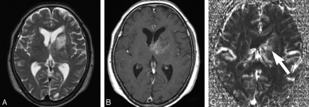 Fig 4.