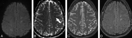   Fig 1. 