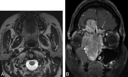 Fig 1.