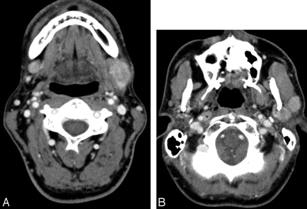 Fig 3.