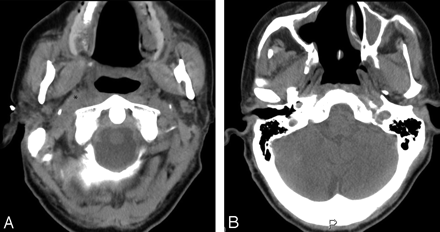 Fig 4.