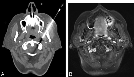 Fig 5.