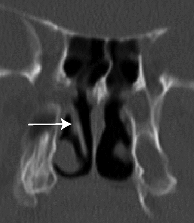 Fig 1.