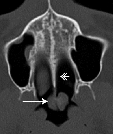 Fig 2.