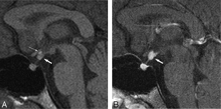 Fig 2.