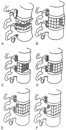 Fig 2.