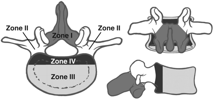 Fig 3.