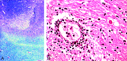 Fig 2.