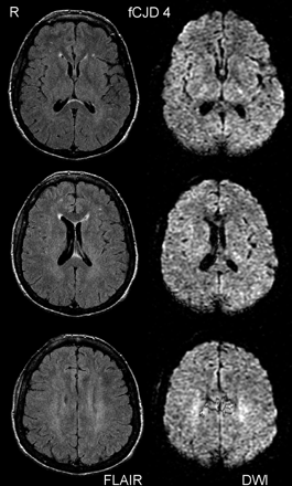 Fig 2.