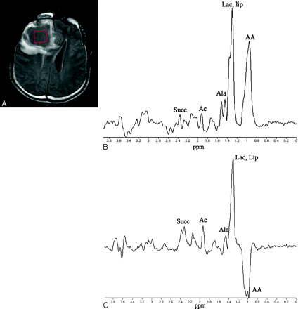 Fig 1.