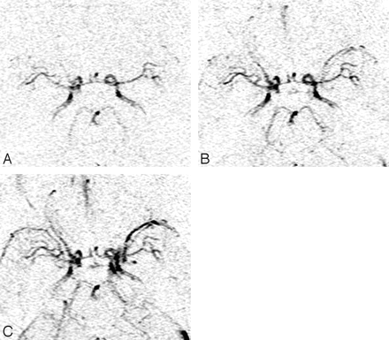 Fig 1.