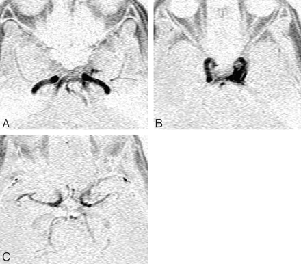 Fig 2.
