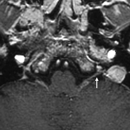 Fig 2.