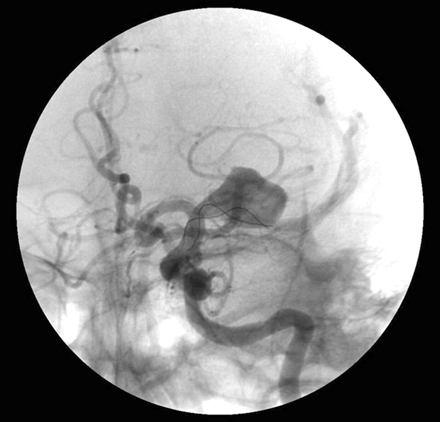 Fig 2.
