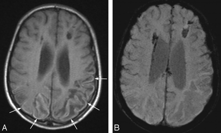 Fig 1.