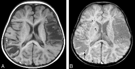 Fig 2.