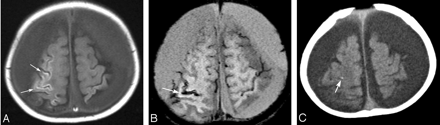 Fig 3.