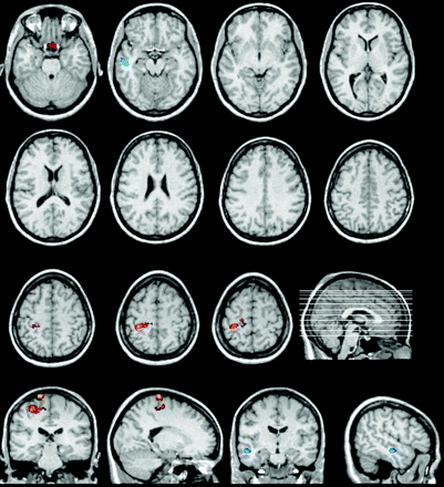 Fig 1.