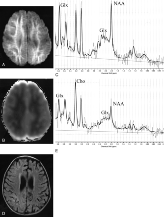 Fig 1.