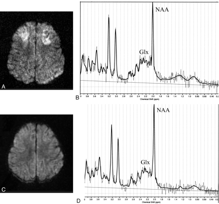 Fig 2.
