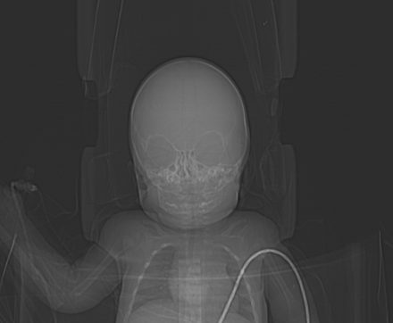 Fig 2.