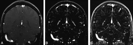 Fig 1.