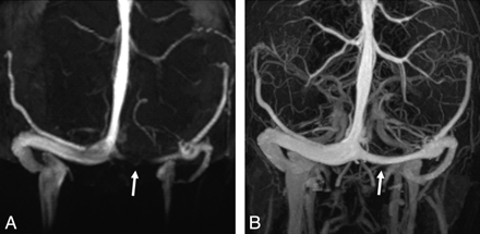 Fig 2.