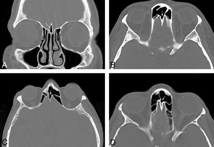 Fig 1.