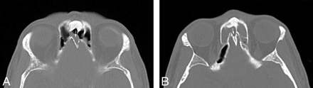 Fig 2.