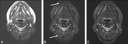 Fig 2.