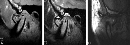 Fig 2.