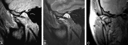 Fig 3.