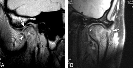 Fig 4.