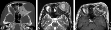 Fig 4.