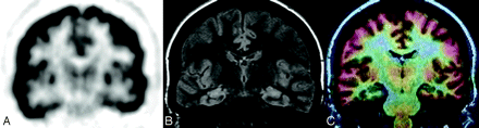 Fig 1.