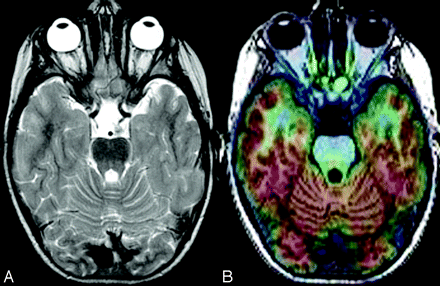 Fig 3.