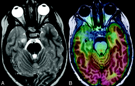 Fig 4.