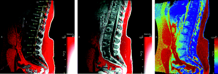 Fig 4.