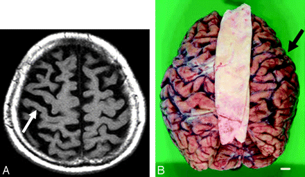 Fig 1.