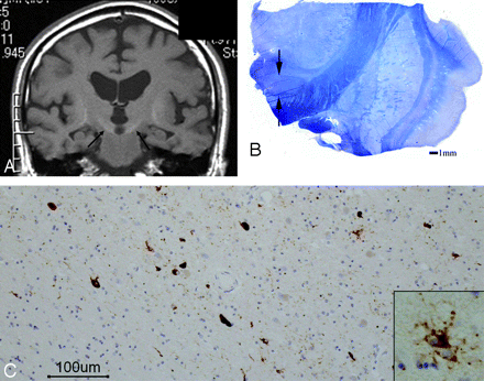 Fig 10.