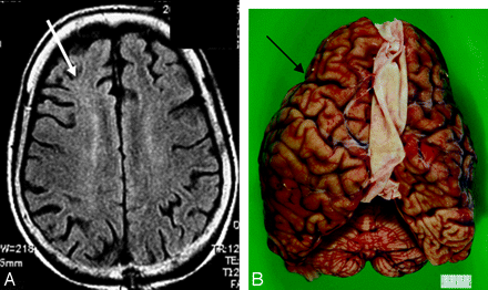 Fig 2.