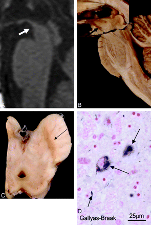 Fig 4.