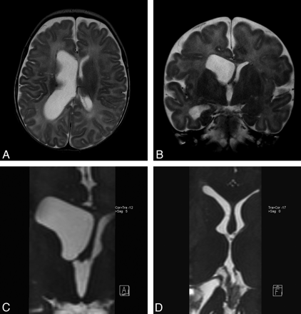 Fig 5.